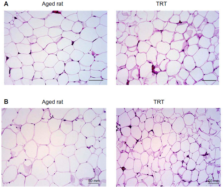 Testosterone replacement alters the cell size in visceral fat but not in subcutaneous fat in hypogonadal aged male rats as a late-onset hypogonadism animal model.