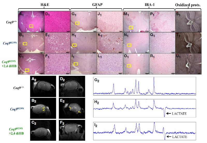 β-RA reduces DMQ/CoQ ratio and recues the encephalopathic phenotype in Coq9R239X mice