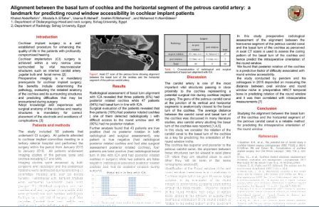 Alignment between the basal turn of cochlea and the horizontal segment of the petrous carotid artery: a landmark for predicting round window accessibility in cochlear implant patients