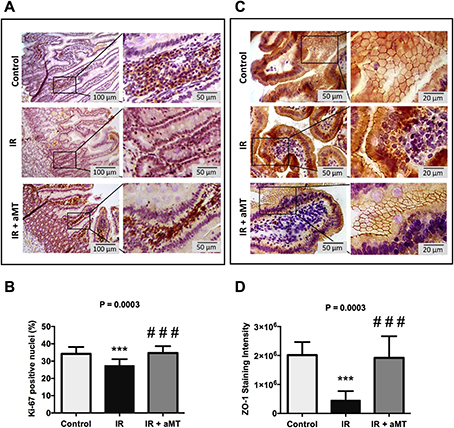 Melatonin protects rats from radiotherapy-induced small intestine toxicity