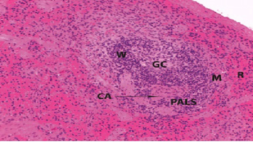 Histological and Immunohistochemical Study of the Possible Protective Effect of Ascorbic Acid on the Toxic Effect of Monosodium Glutamate on the Spleen of Adult Male Albino Rat