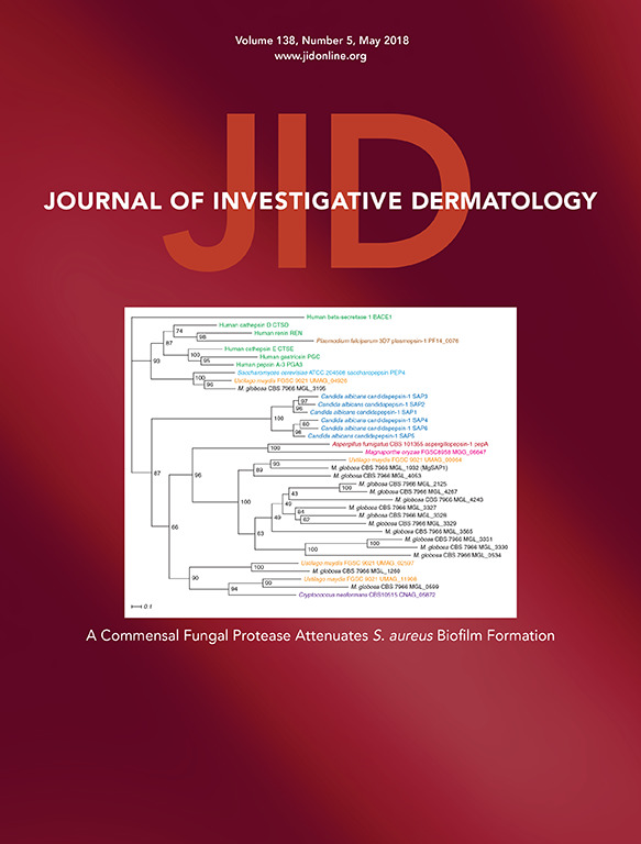 Comparative study of the immunological profile in stable segmental and non-segmental Vitiligo patients undergoing melanocyte keratinocyte transplantation.