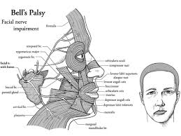 Prevalence of Bell’s palsy in Qena Governorate, Egypt