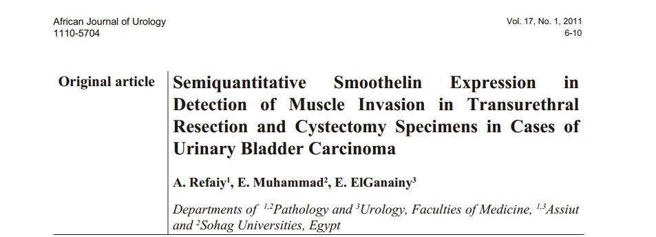 Semiquantitative Smoothelin Expression in Detection of Muscle Invasion in Transurethral Resection and Cystectomy Specimens in Cases of Urinary Bladder Carcinoma