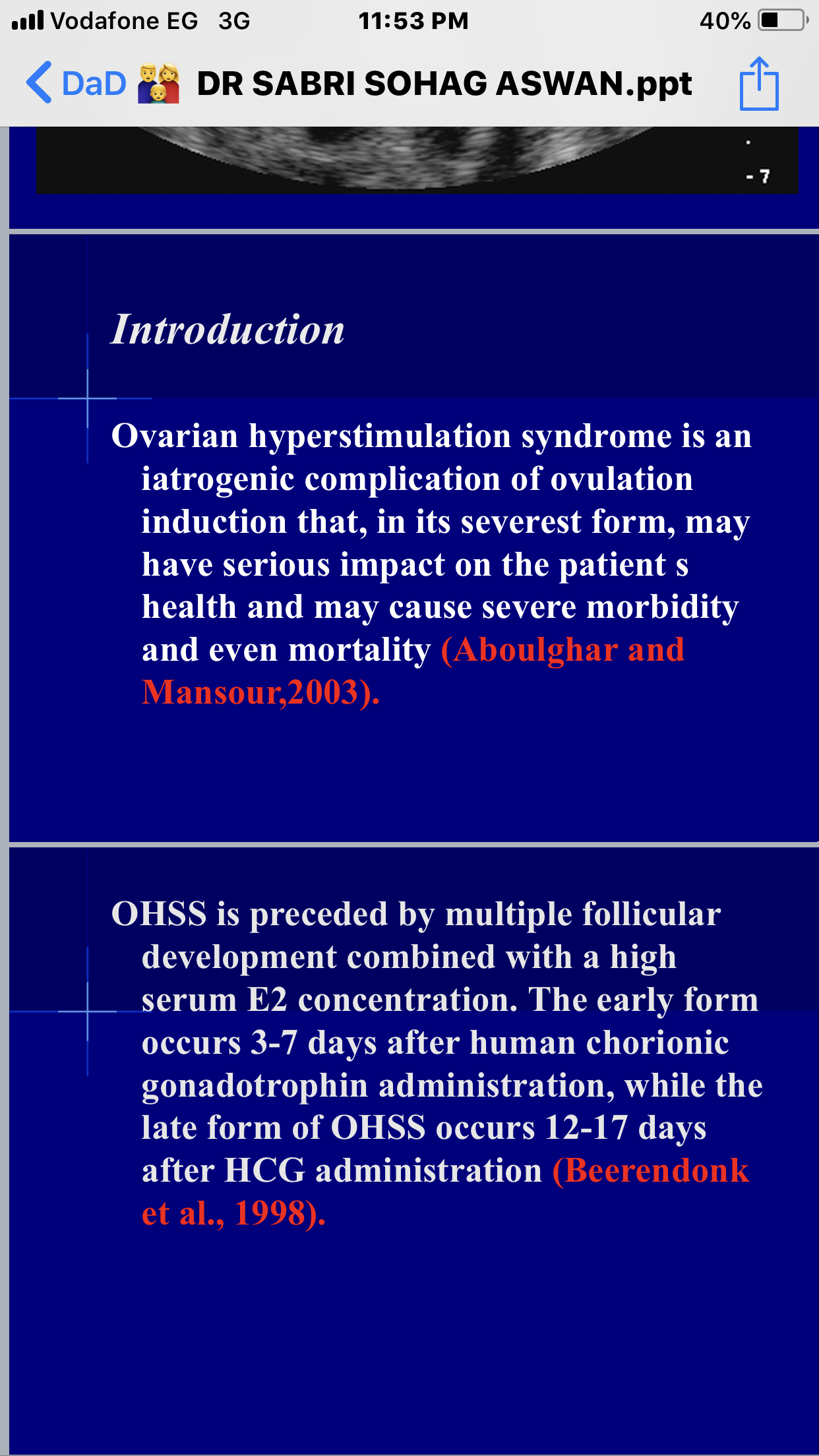 Management of ovarian hyper stimulation syndrome