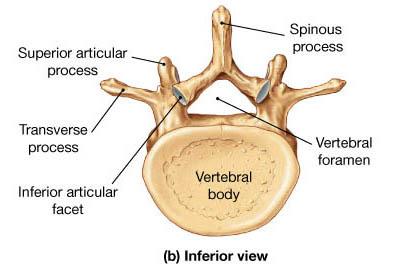 What is the description of typical vertebrae ?