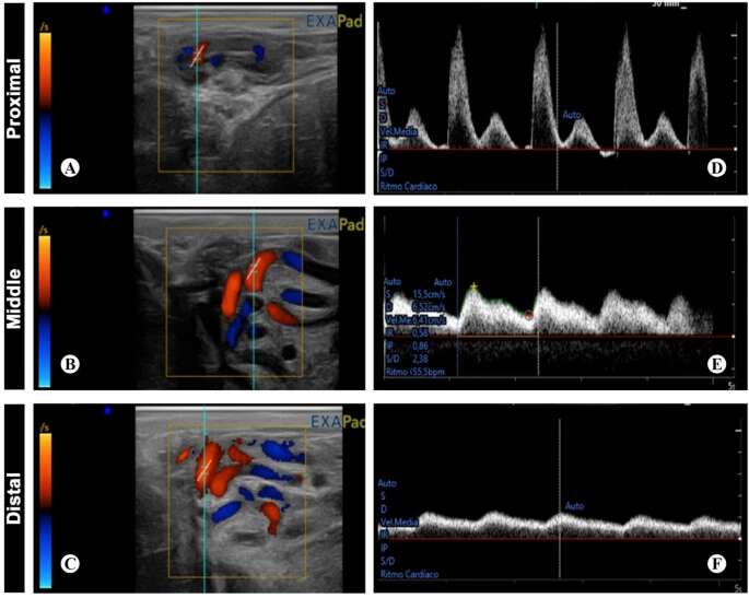 Morphological and ultrasonographic characterization of the three zones of supratesticular region of testicular artery in Assaf rams