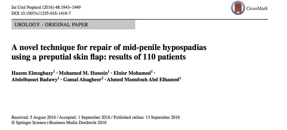 A novel technique for repair of mid‐penile hypospadias using a preputial skin flap: results of 110 patients