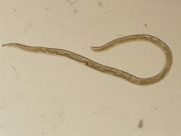Common Parasitic Infestation among Rural Population in Sohag Governorate, Egypt" .