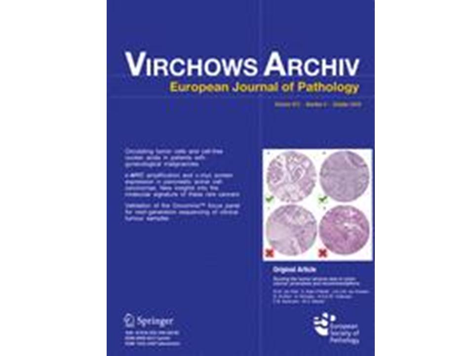 Detection of JC virus DNA sequences in colorectal cancers in Japan