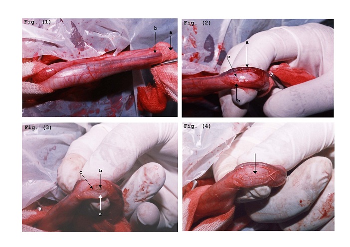 Dorsal versus ventral urethrotomy technique for treatment of obstructive urethrolithiasis in cattle calves