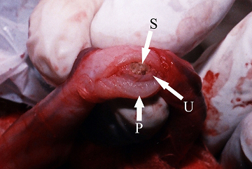 New surgical technique for treatment of obstructive penile urethrolithiasis without interference with breeding capability: Clinical study on 25 calves