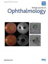 Dr. Iqbal is a reviewer for British Journal of Ophthalmology